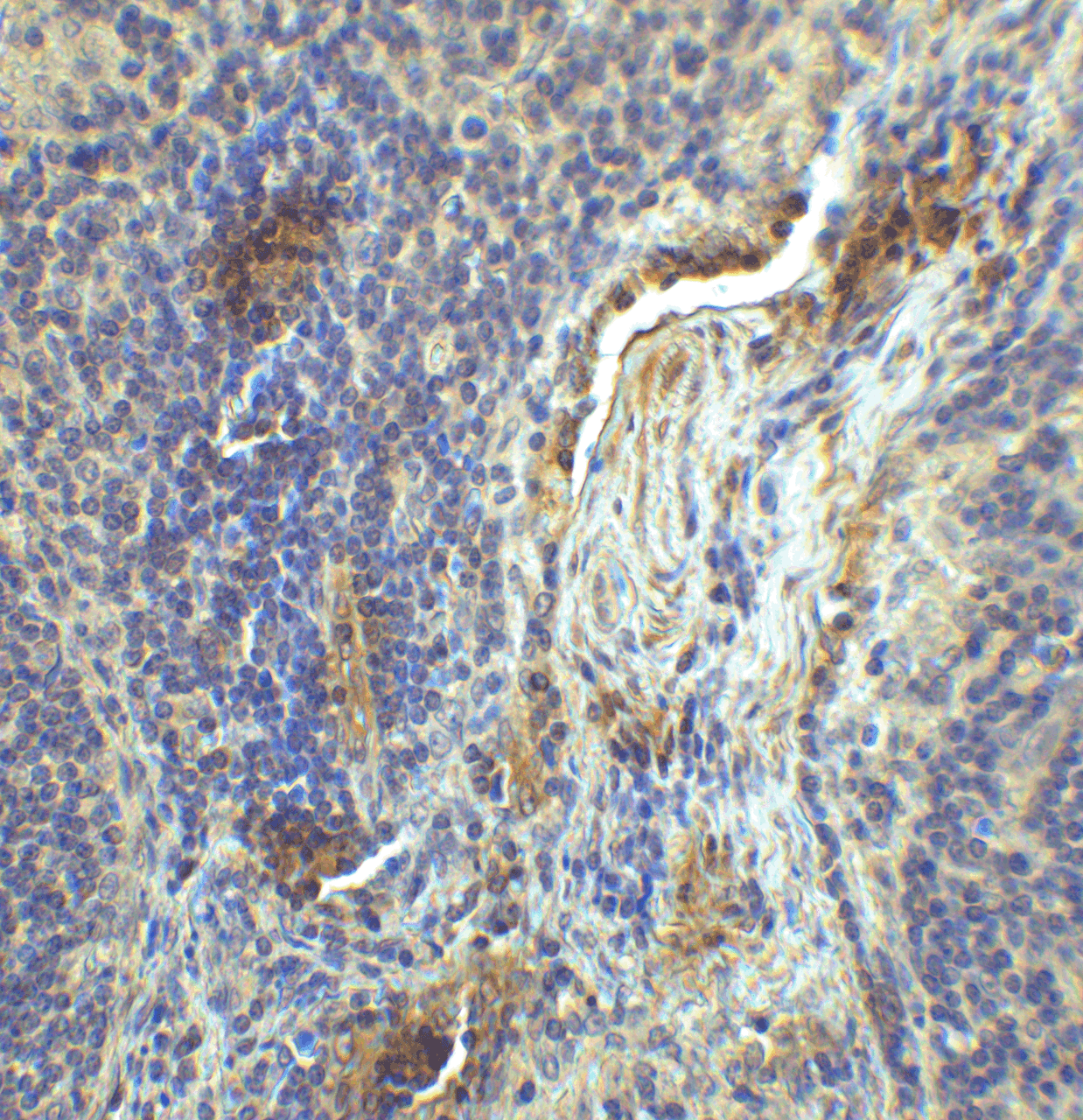 Immunohistochemistry of LAG-3 in human lymph node tissue with LAG-3 single domain antibody at 1 &#956;g/mL.