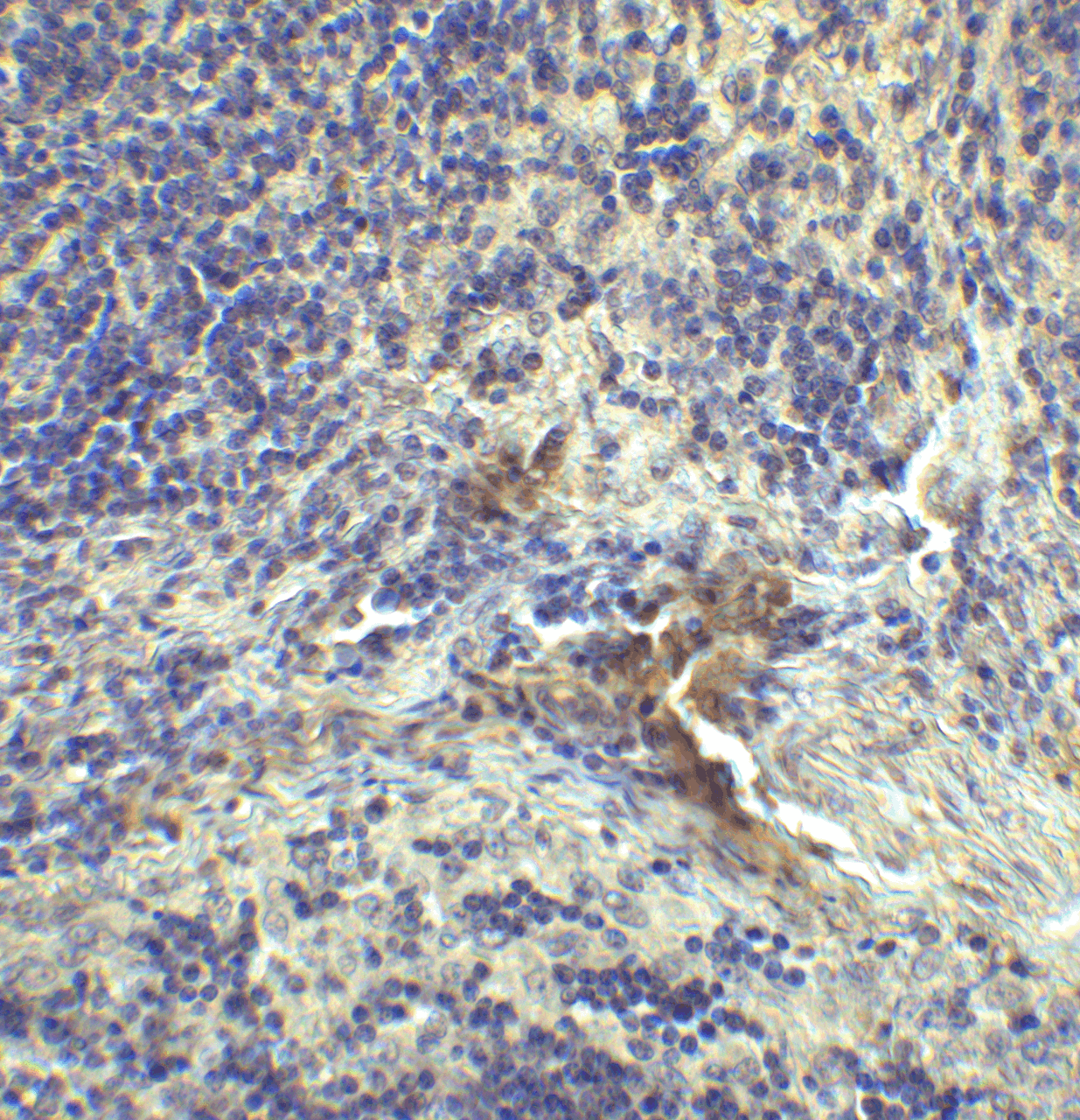 Immunohistochemistry of LAG-3 in human lymph node tissue with LAG-3 single domain antibody at 1 &#956;g/mL.