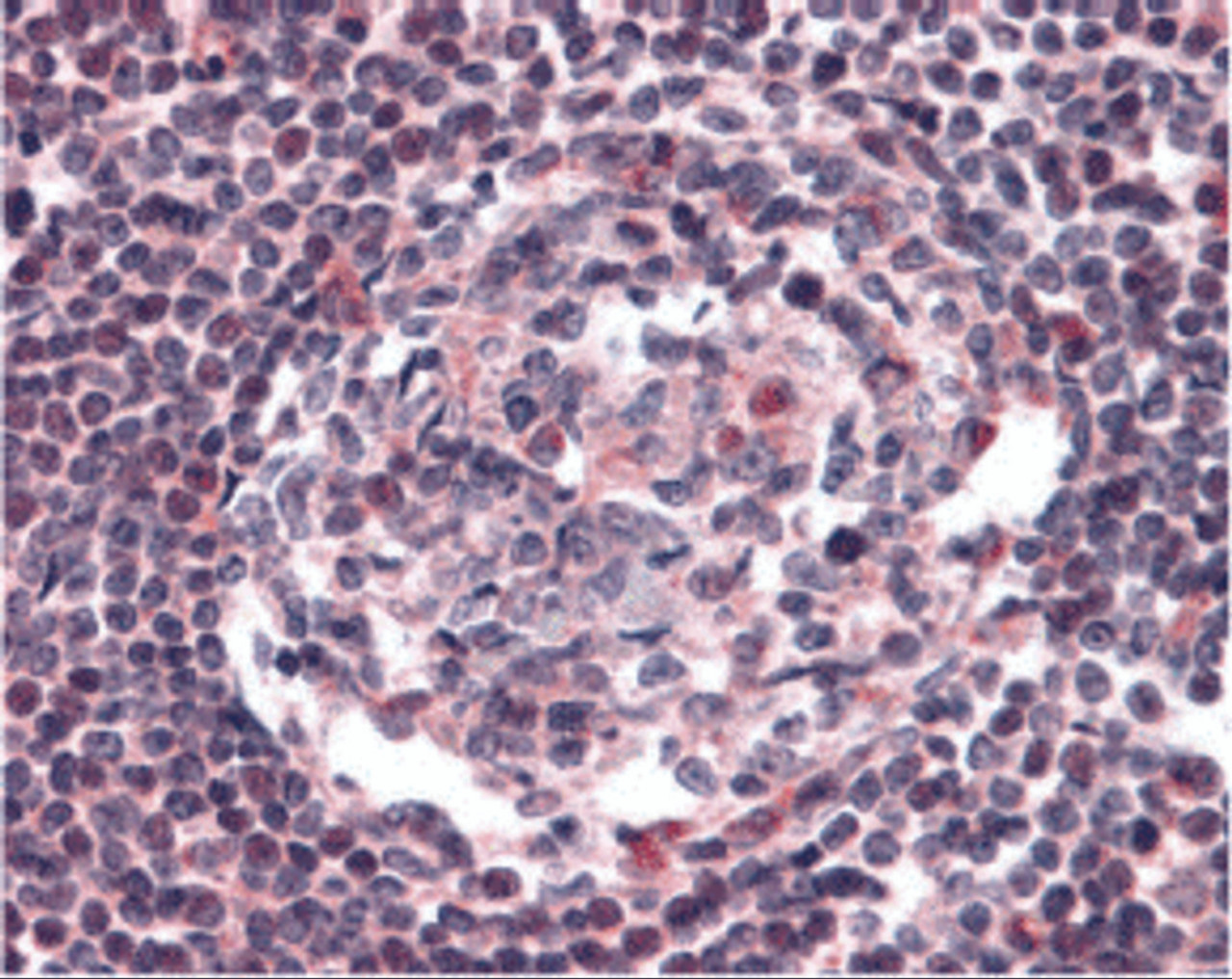 Immunohistochemistry of CCR5 in human lymph node tissue with CCR5 antibody at 20 &#956;g/mL.