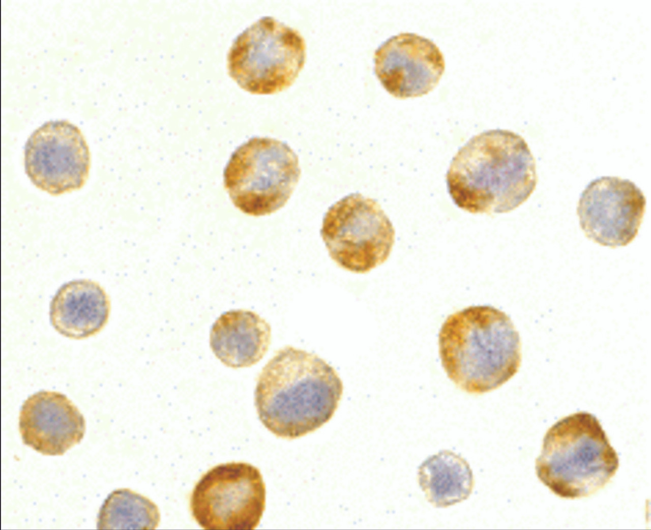 Immunocytochemistry of RAIDD in HeLa cells with RAIDD antibody at 5 &#956;g/mL.