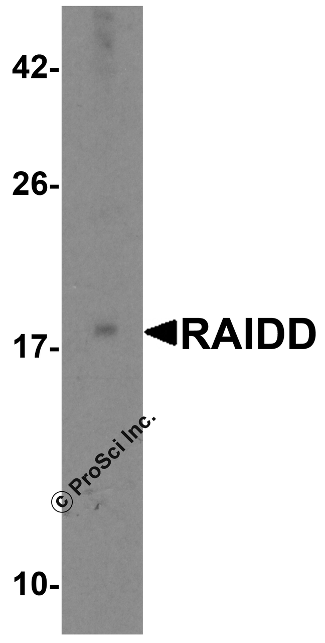 Western blot analysis of RAIDD in MCF7 total cell lysate with RAIDD antibody at 2 &#956;g/mL.