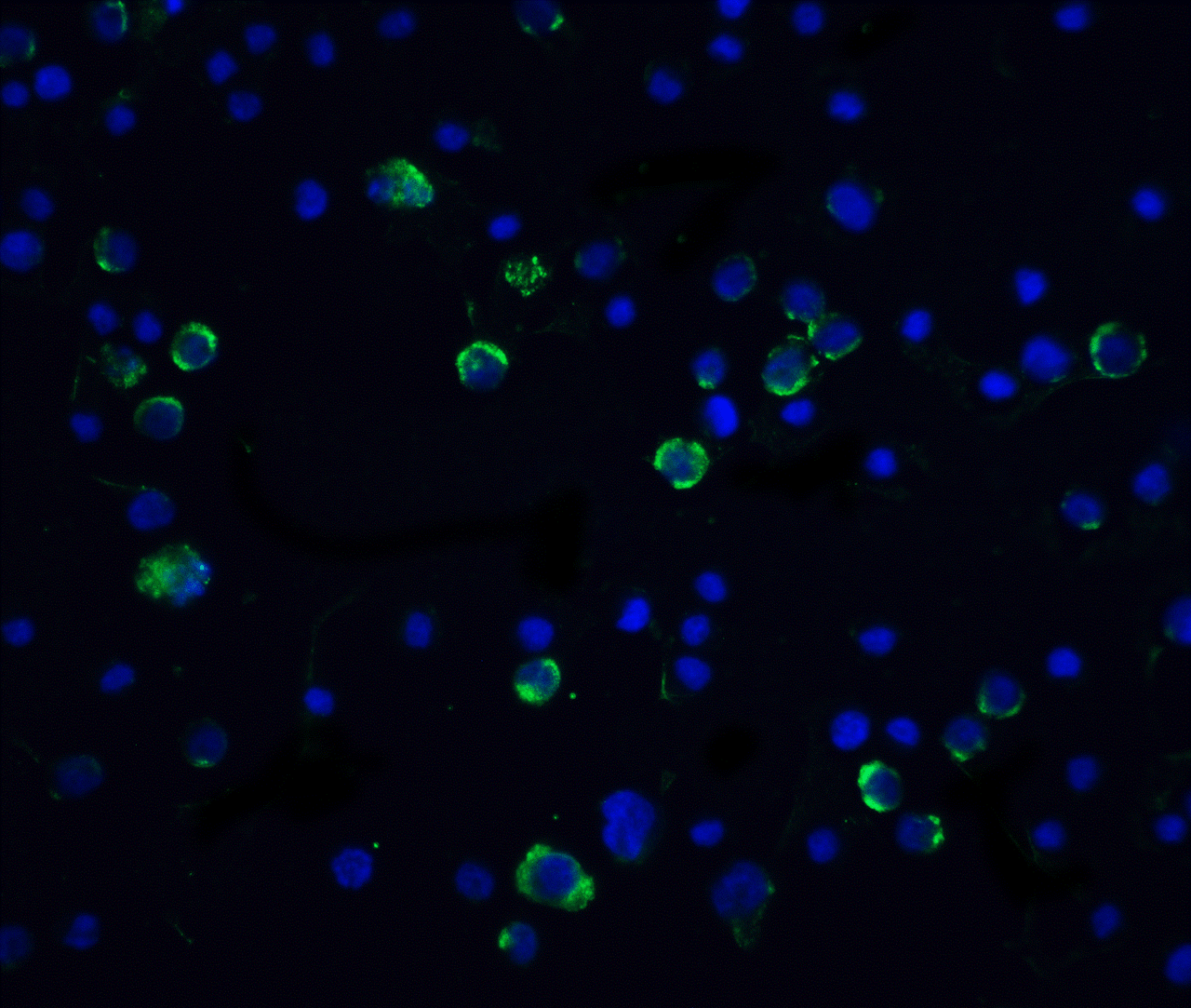 Immunofluorescence of Casp10 in Hela cells with Caspase 10 antibody at 20 &#956;g/mL.<br><br>Green: Caspase-10 Antibody (1128) <br> Blue: DAPI staining