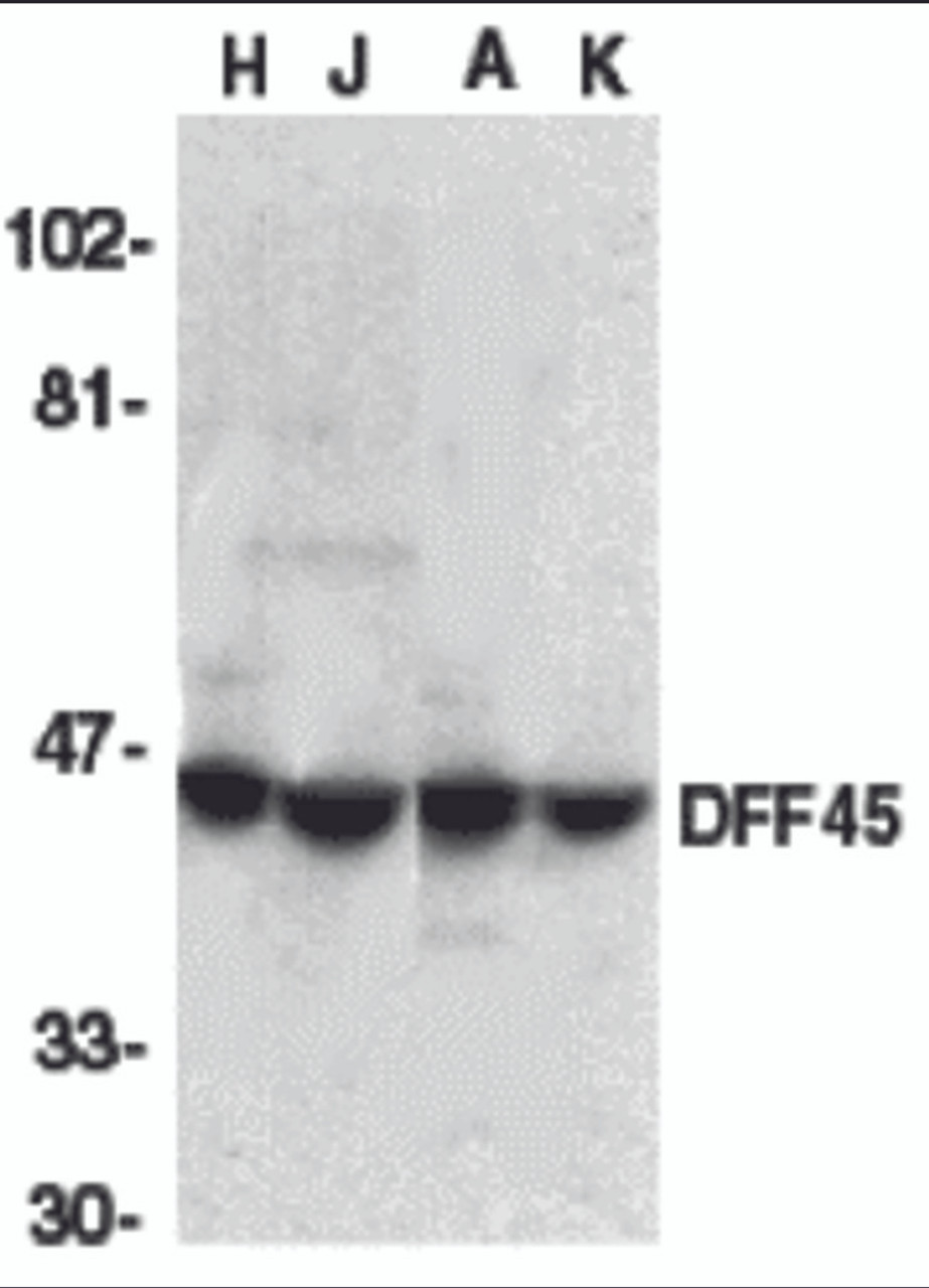 Western blot analysis of DFF45 in HeLa (H), Jurkat (J), A431 (A), and K562 (K) whole cell lysate with DFF45 antibody at 1:1000 dilution.
