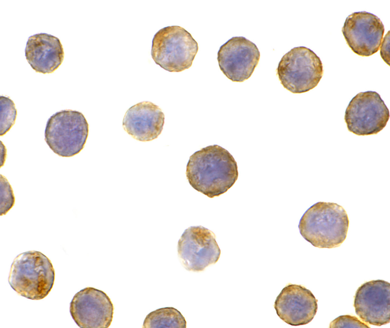 Immunocytochemistry of DFF45 in HeLa cells with DFF45 antibody at 5 &#956;g/mL.