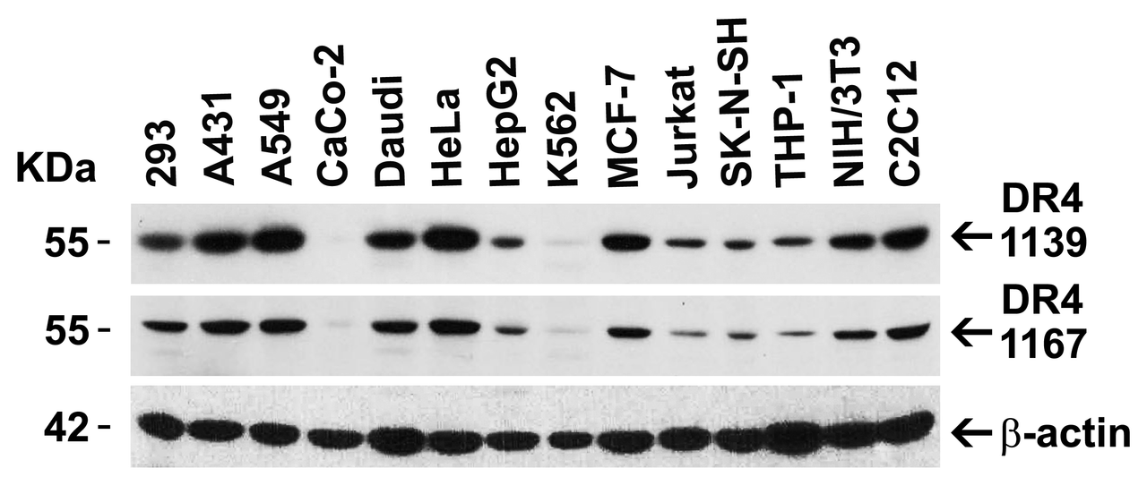 Figure 2 Independent Antibody Validation (IAV) via Protein Expression Profile in Cell Lines
Loading: 15 ug of lysates per lane.
Antibodies: DR4 1139 (1 ug/mL) , DR4 1167 (4 ug/mL) , beta-actin (1 ug/mL) , and GAPDH (0.02 ug/mL) , 1h incubation at RT in 5% NFDM/TBST.
Secondary: Goat anti-rabbit IgG HRP conjugate at 1:10000 dilution.