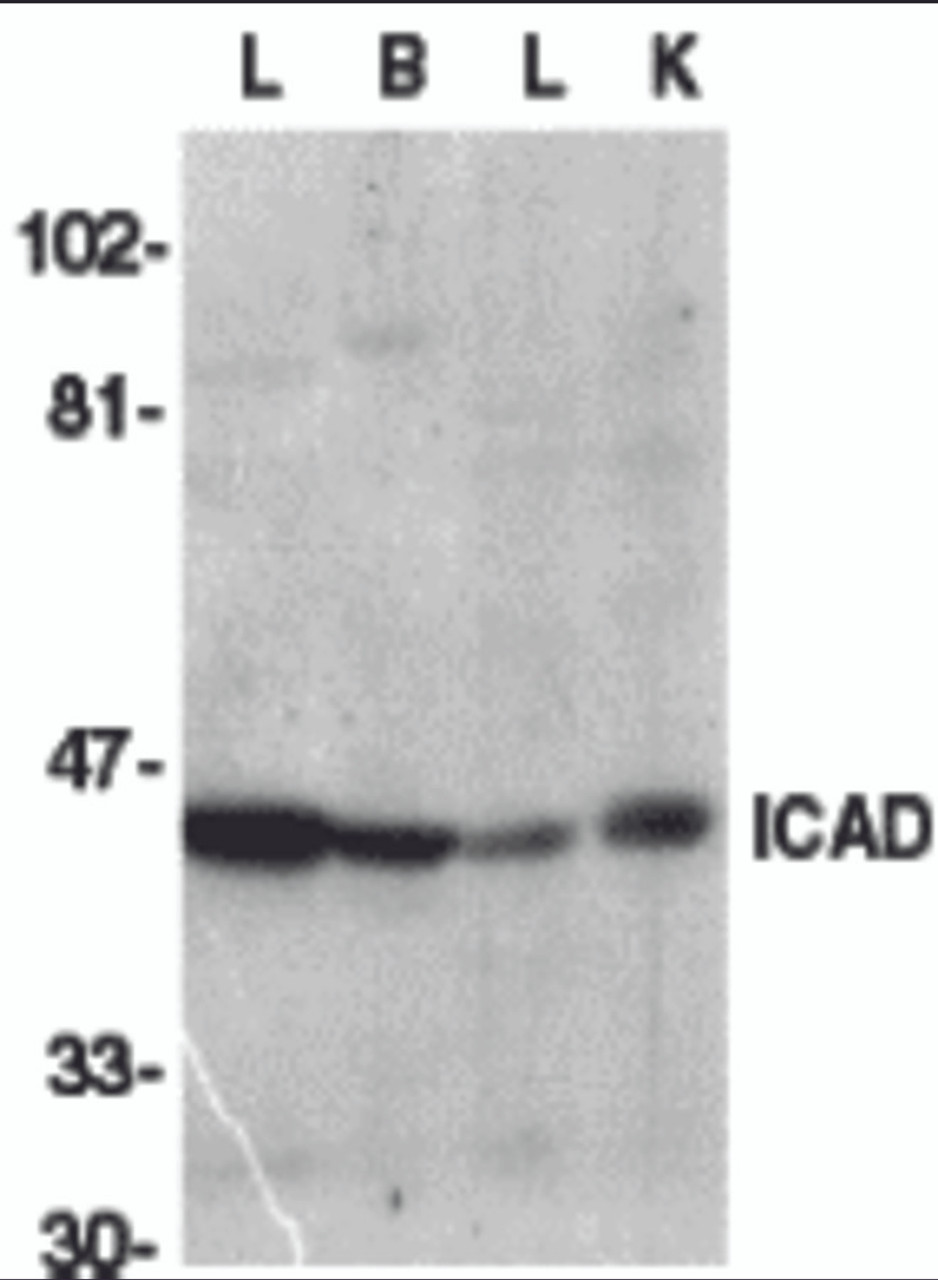 Secondary: Goat anti-rabbit IgG HRP conjugate at 1:10000 dilution.