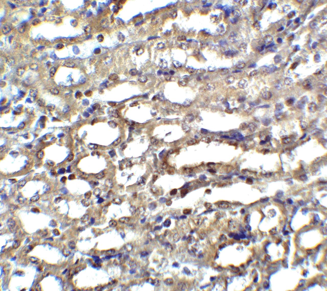 Immunohistochemistry of ICAD in mouse kidney tissue with ICAD antibody at 5 ug/ml.