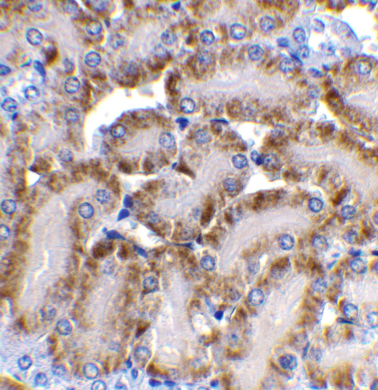 Immunohistochemistry of CAD in mouse kidney tissue with CAD antibody at 2 ug/mL.