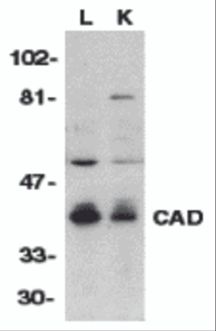 Western blot analysis of CAD in mouse lung (L) and kidney (K) tissue lysates with CAD antibody at 1:500 dilution.