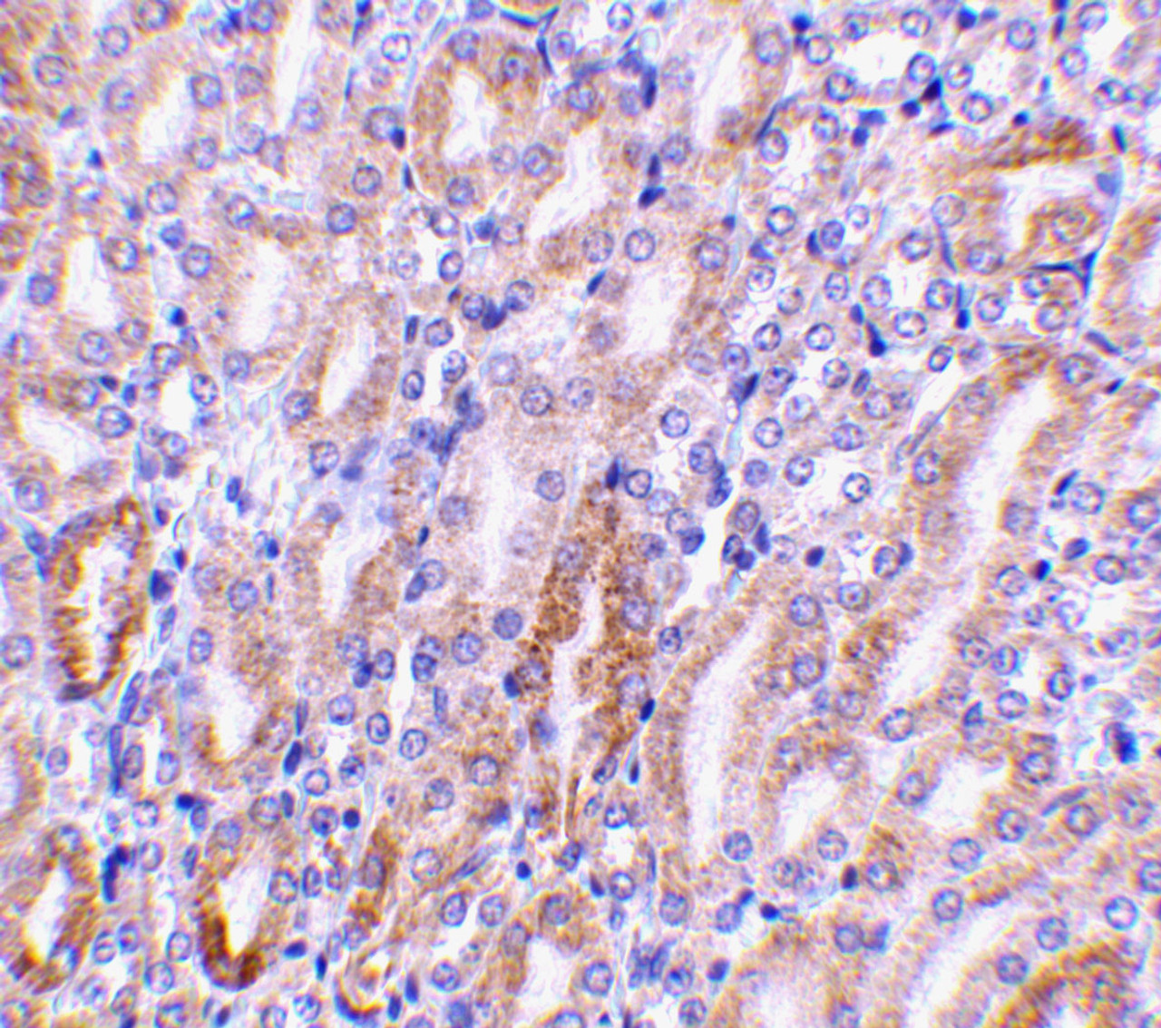 Immunohistochemistry of CAD in mouse kidney tissue with CAD antibody at 1 ug/mL.