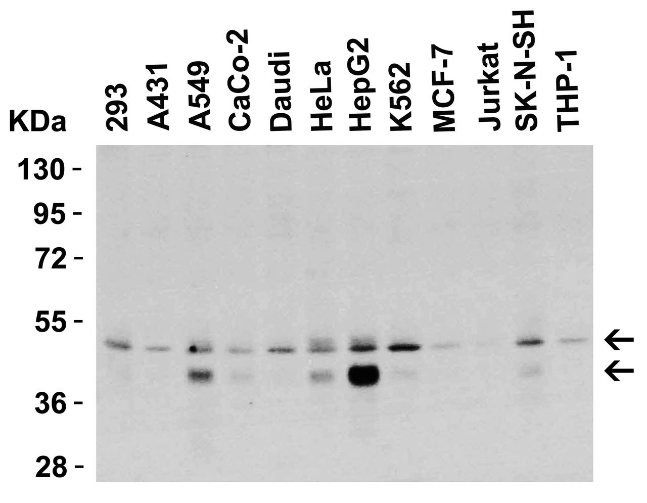Figure 1 Western Blot Validation in Human Cell Lines
Loading: 15 &#956;g of lysates per lane.
Antibodies: DR5 2019, (0.5 &#956;g/mL) , 1h incubation at RT in 5% NFDM/TBST.
Secondary: Goat anti-rabbit IgG HRP conjugate at 1:10000 dilution.