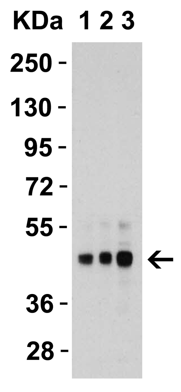 Figure 2 Western Blot Validation in Human HepG2 Cells
Loading: 15 ug of lysates per lane.
Antibodies: DR5 2019, 1h incubation at RT in 5% NFDM/TBST.
Secondary: Goat anti-rabbit IgG HRP conjugate at 1:10000 dilution.
Lane 1: 1 ug/mL
Lane 2: 2 ug/mL
Lane 3: 4 ug/mL