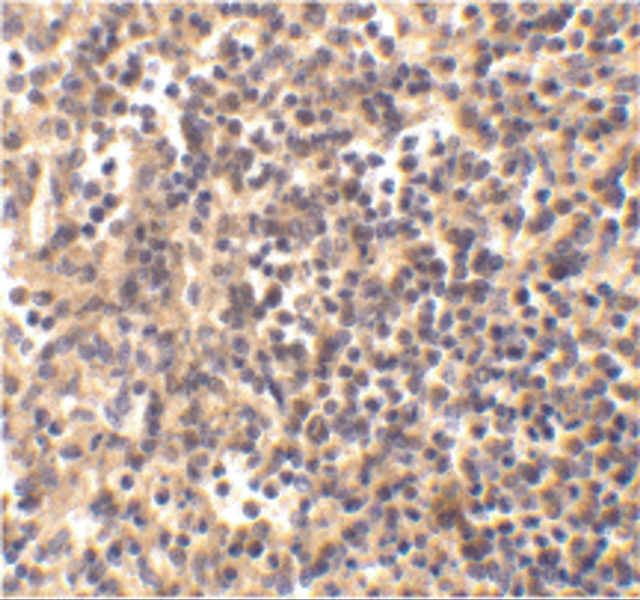 Immunohistochemistry of DNaseII in human spleen tissue with DNaseII antibody at 5 ug/mL.