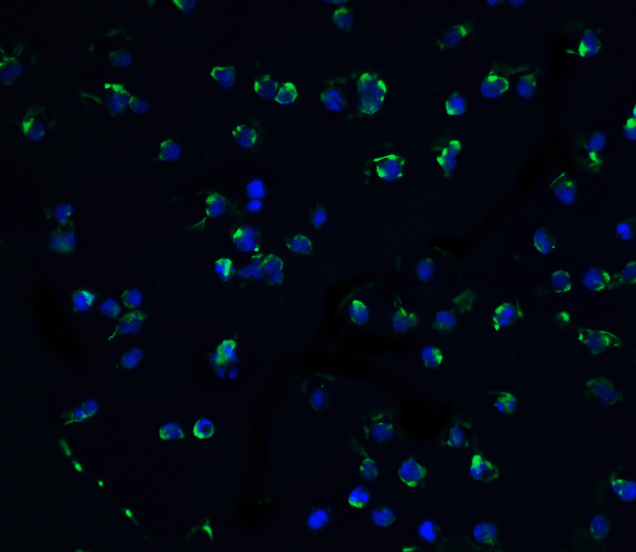 Immunofluorescence of ZIPK in Jurkat cells with ZIPK antibody at 10 ug/mL.