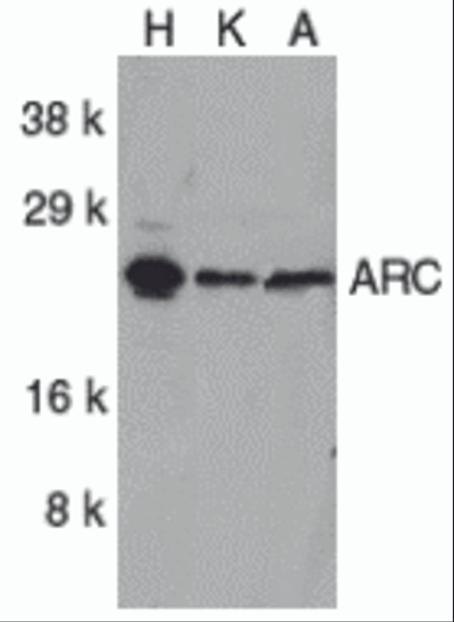 Western blot analysis of ARC in (H) HeLa, (K) K562, and (A) A549 whole cell lysates with ARC antibody at 1 &#956;g/mL.