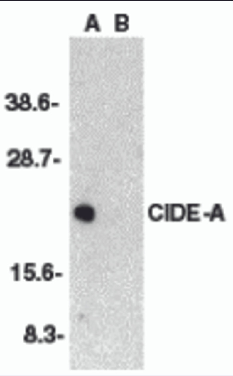 Western blot analysis of CIDE-A in human brain tissue lysate in the absence (A) or presence (B) of peptide (2085P) with CIDE-A antibody at 1:2000 dilution.
