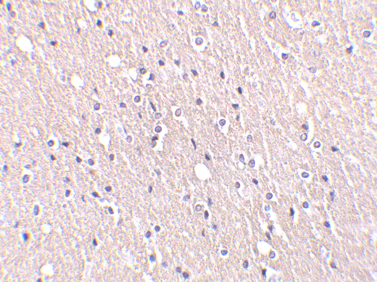 Immunohistochemistry of CIDE-A in human brain tissue with CIDE-A antibody at 5 ug/mL.