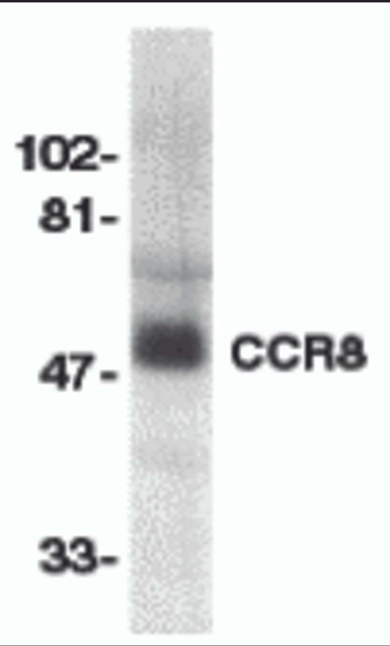 Western blot analysis of CCR8 in human spleen lysate with CCR8 antibody at 1:500 dilution.