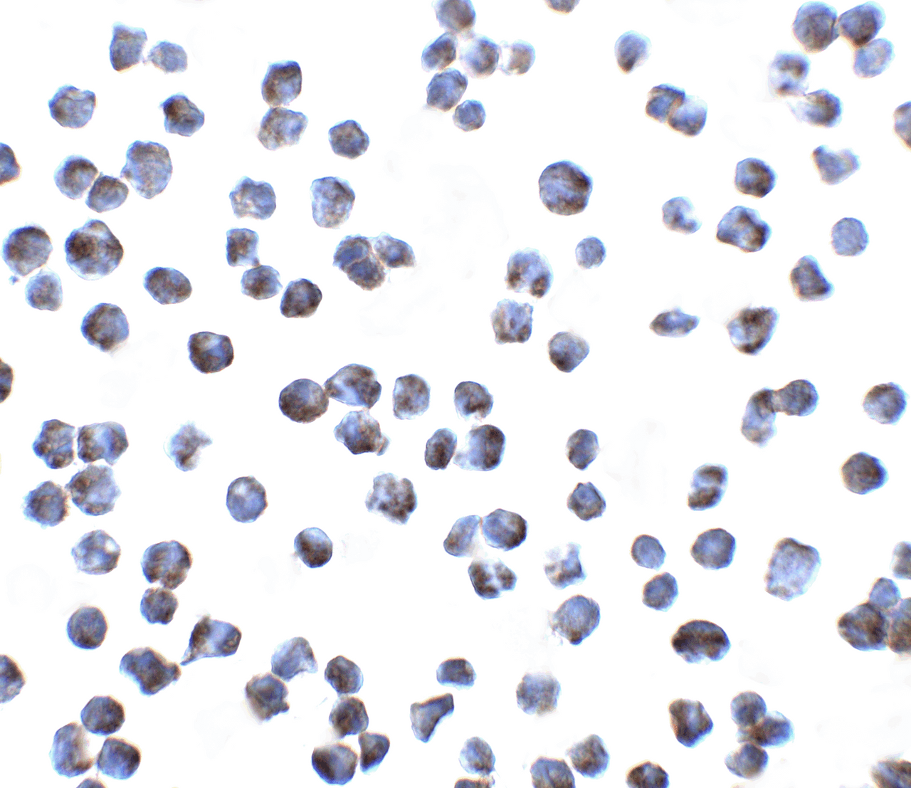 Immunocytochemistry of GPR15 in A431 cells with GPR15 antibody at 5 ug/ml.