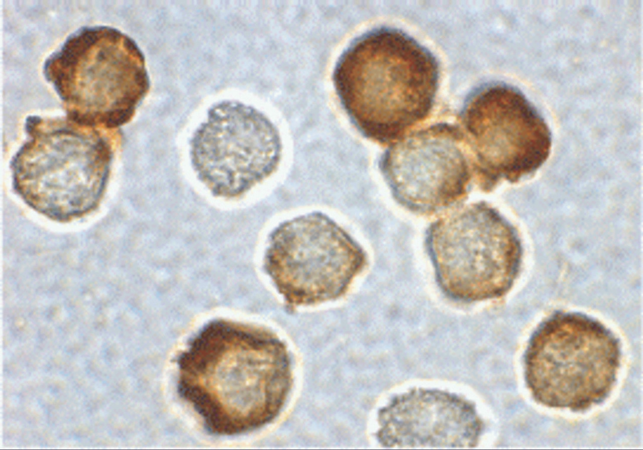 Immunocytochemical staining of HeLa cells using IRAK2 antibody at 2 ug/mL.