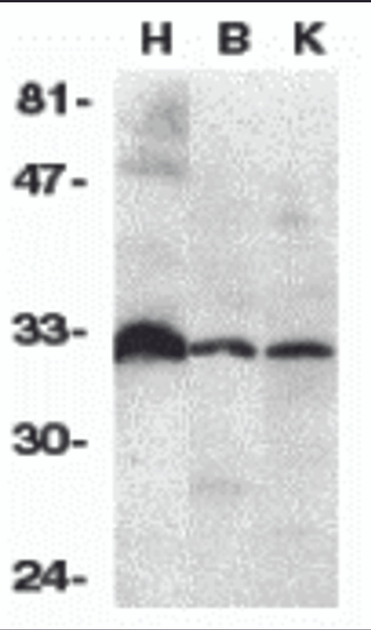 Western blot analysis of DcR3 in human heart (H) , brain (B) , and kidney (K) tissue lysates with DcR3 antibody at 1:500 dilution.