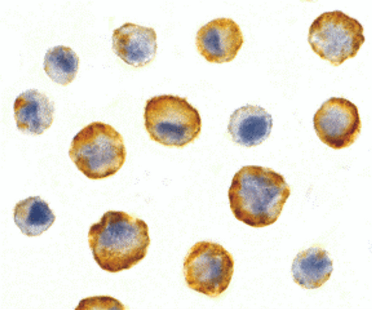 Immunocytochemistry of SODD in HeLa cells with SODD antibody at 5 ug/mL.