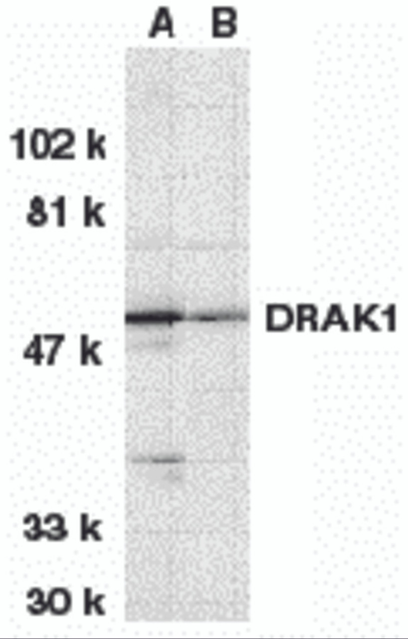 Western blot analysis of DRAK1 in (A) MOLT4 and (B) A431 whole cell lysates with DRAK1 antibody at 1 &#956;g/mL.