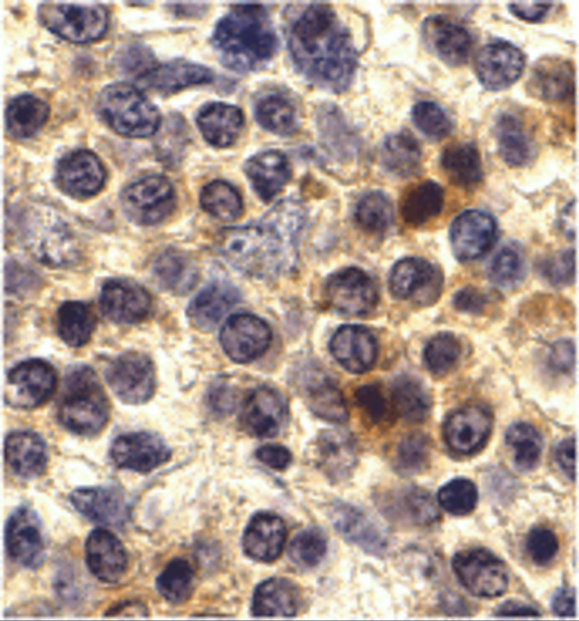 Immunohistochemistry of CX3CR1 in human spleen cells with CX3CR1 antibody at 10 ug/mL.