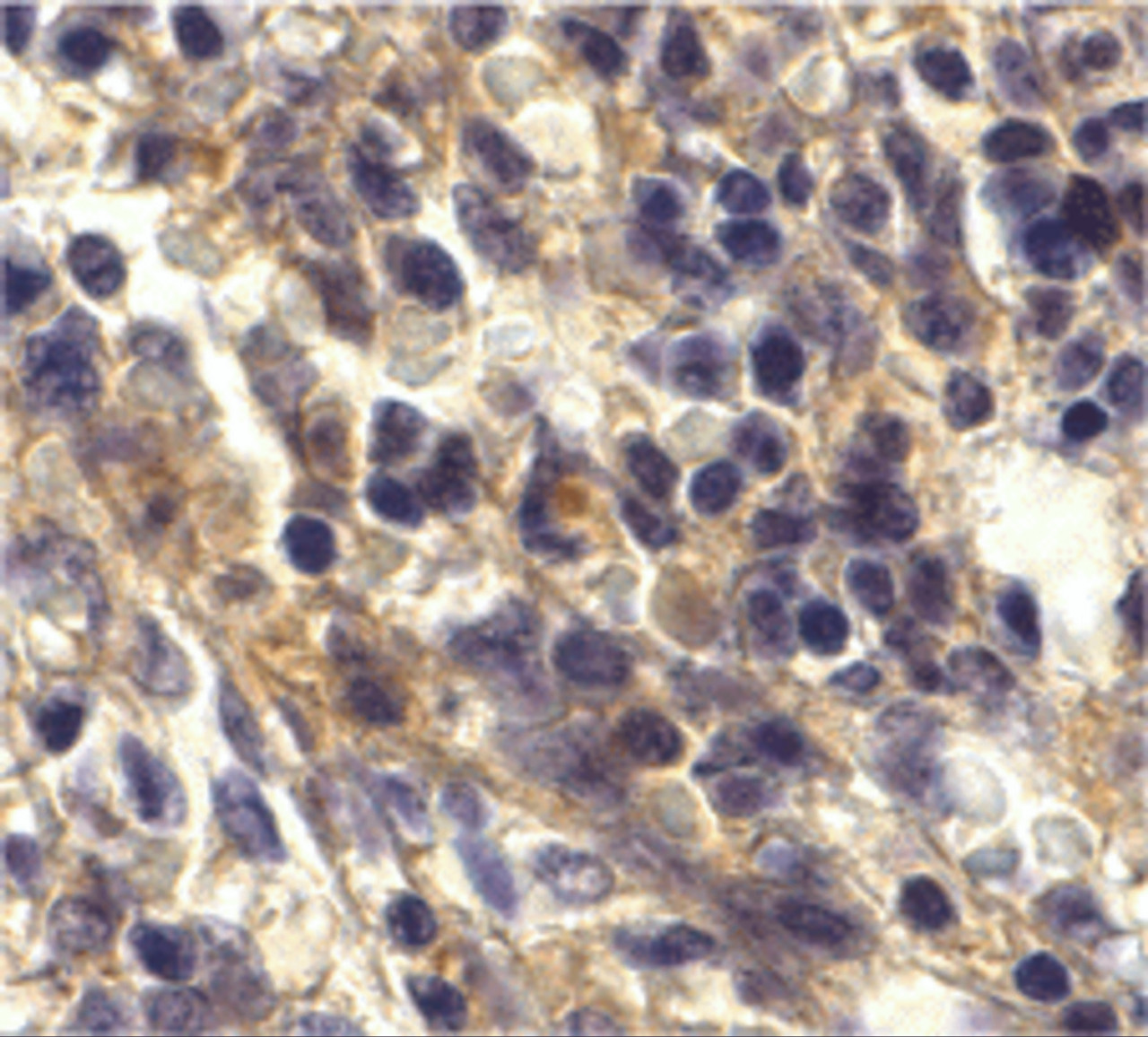 Immunohistochemistry of Bonzo in human spleen tissue with Bonzo antibody at 20 ug/mL.