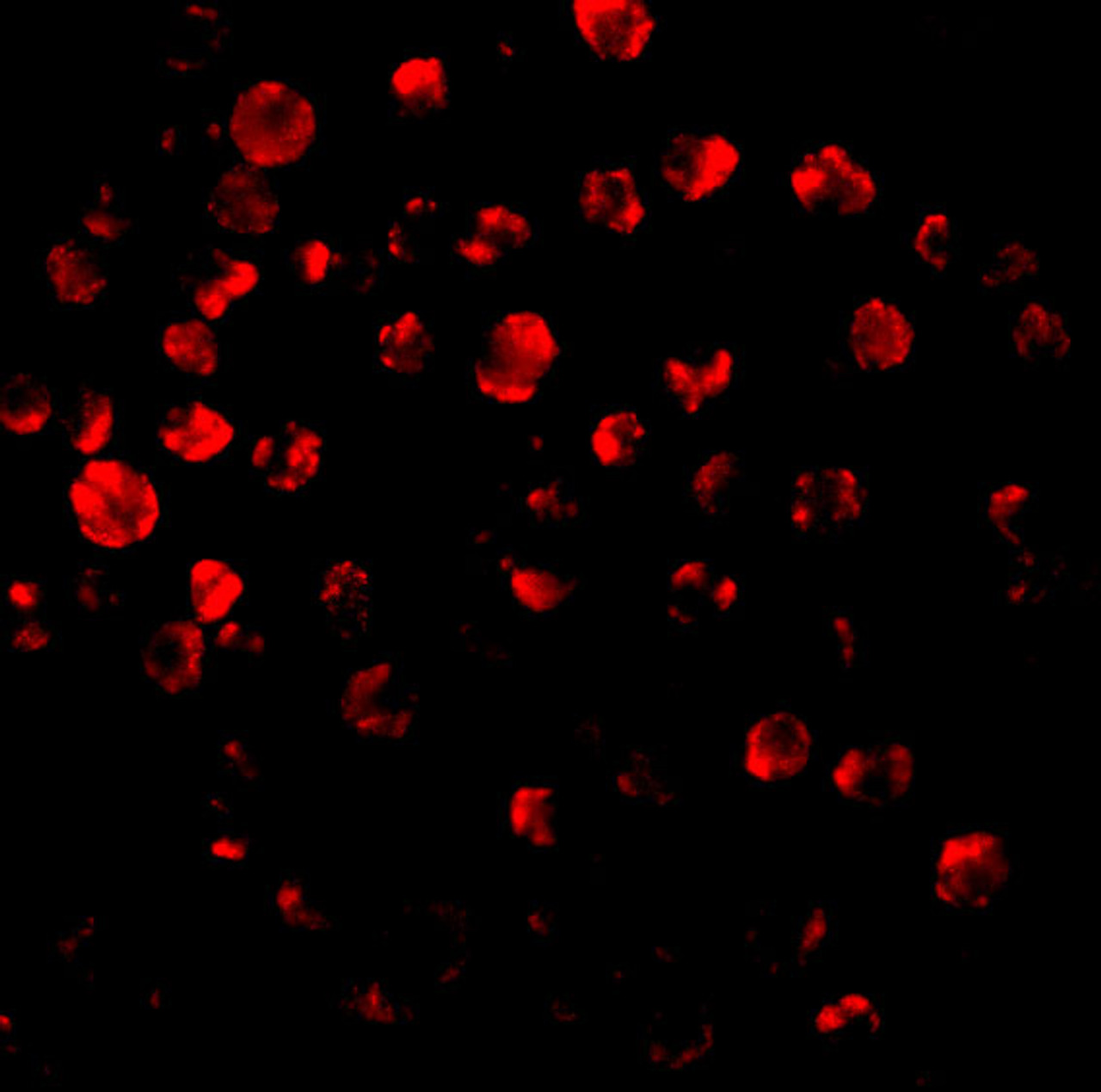 Immunofluorescence of IRAK2 in HeLa cells with IRAK antibody at 10 ug/mL.
