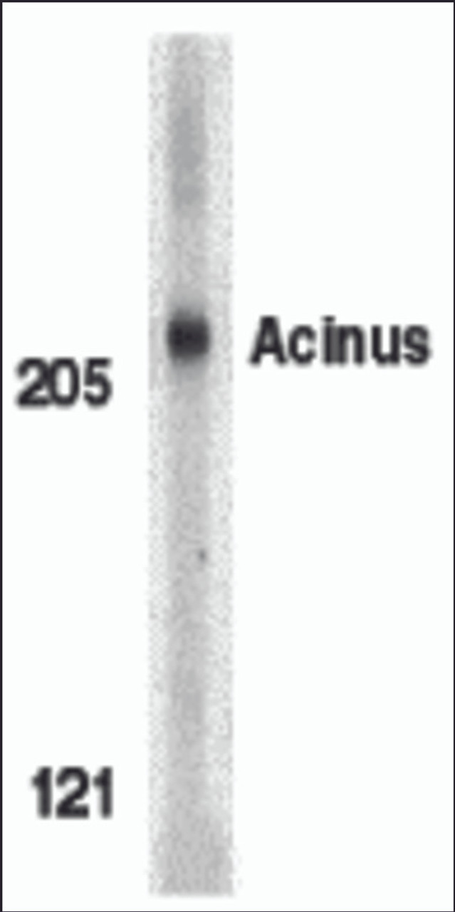 Western blot analysis of Acinus in K562 whole cell lysate with Acinus antibody (IN) at 1 &#956;g/mL.