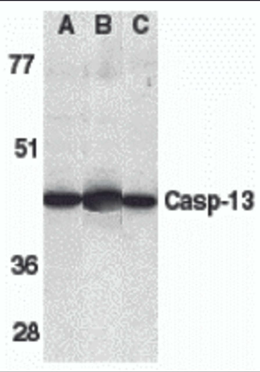 Western blot analysis of caspase-13 in human HL60 cell lysate (A) , mouse brain (B) and rat brain (C) tissue lysates with caspase-13 antibody at 1 &#956;g/mL.