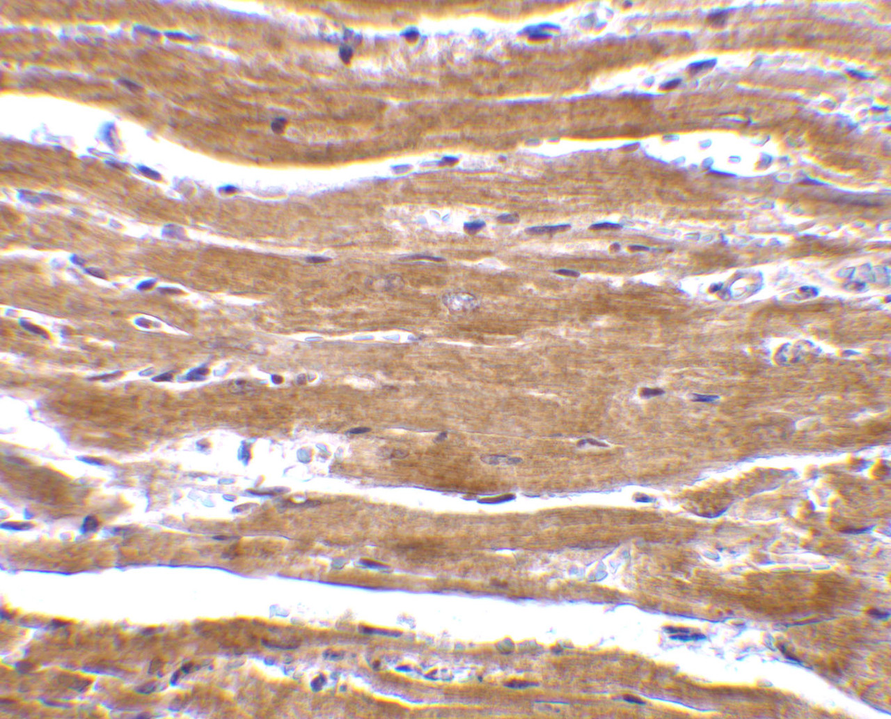 Immunohistochemistry of BACE2 in mouse heart with BACE2 antibody at 10 ug/mL.