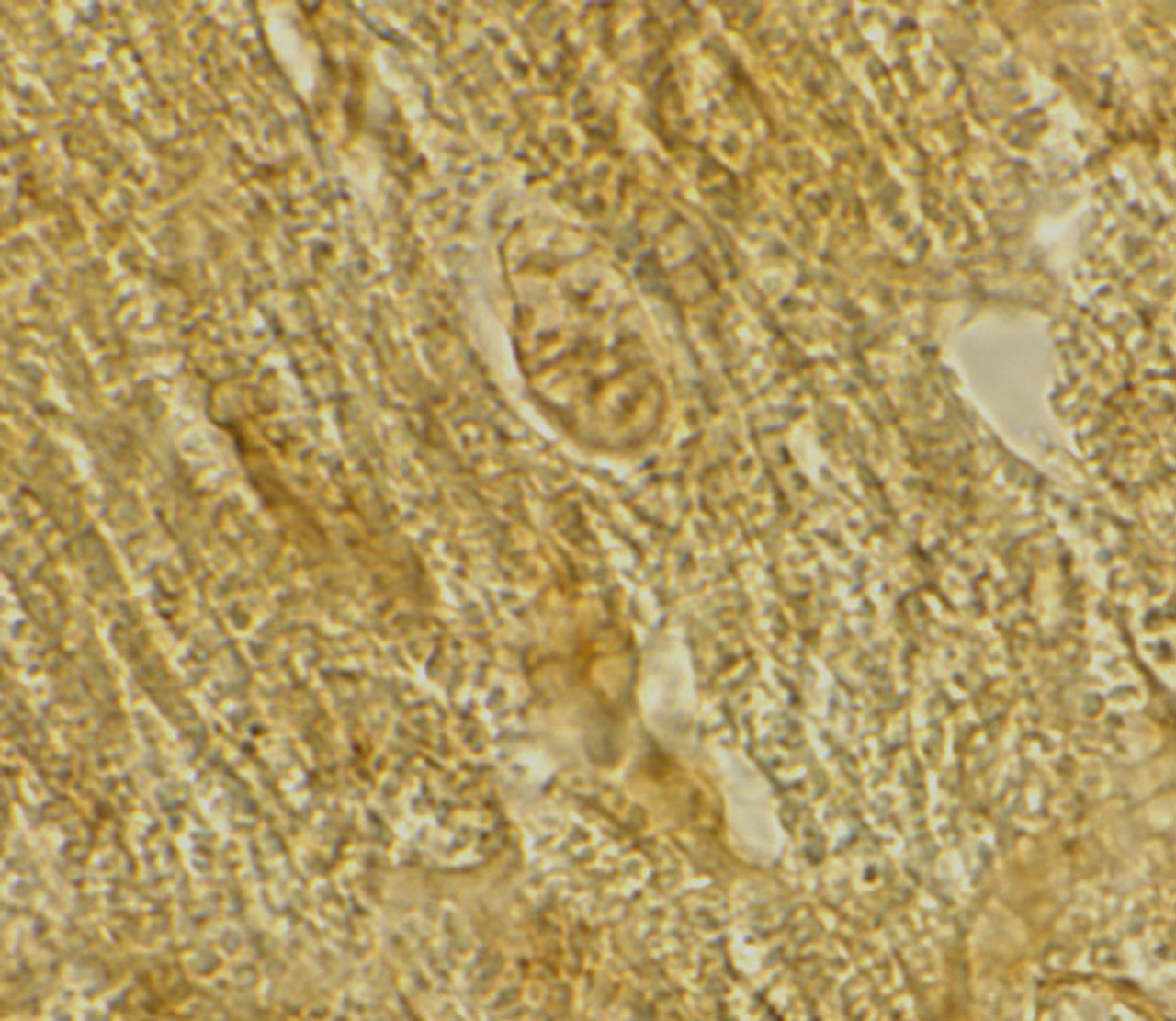 Immunohistochemistry of BACE2 in rat heart tissue with BACE2 antibody at 2 ug/mL.