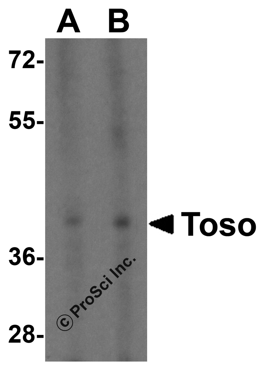 Western blot analysis of TOSO in K562 cell lysate with TOSO antibody at (A) 1 and (B) 2 &#956;g/mL.