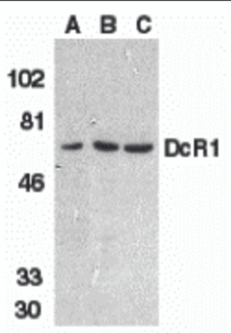 Western blot analysis of DcR1 in HeLa cell (A) , mouse (B) and rat (C) liver tissue lysates with DcR1 antibody at 1 &#956;g/mL.