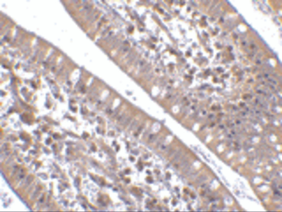 Immunohistochemistry of CIDE-B in human small intestine tissue with CIDE-B antibody at 5 ug/mL.