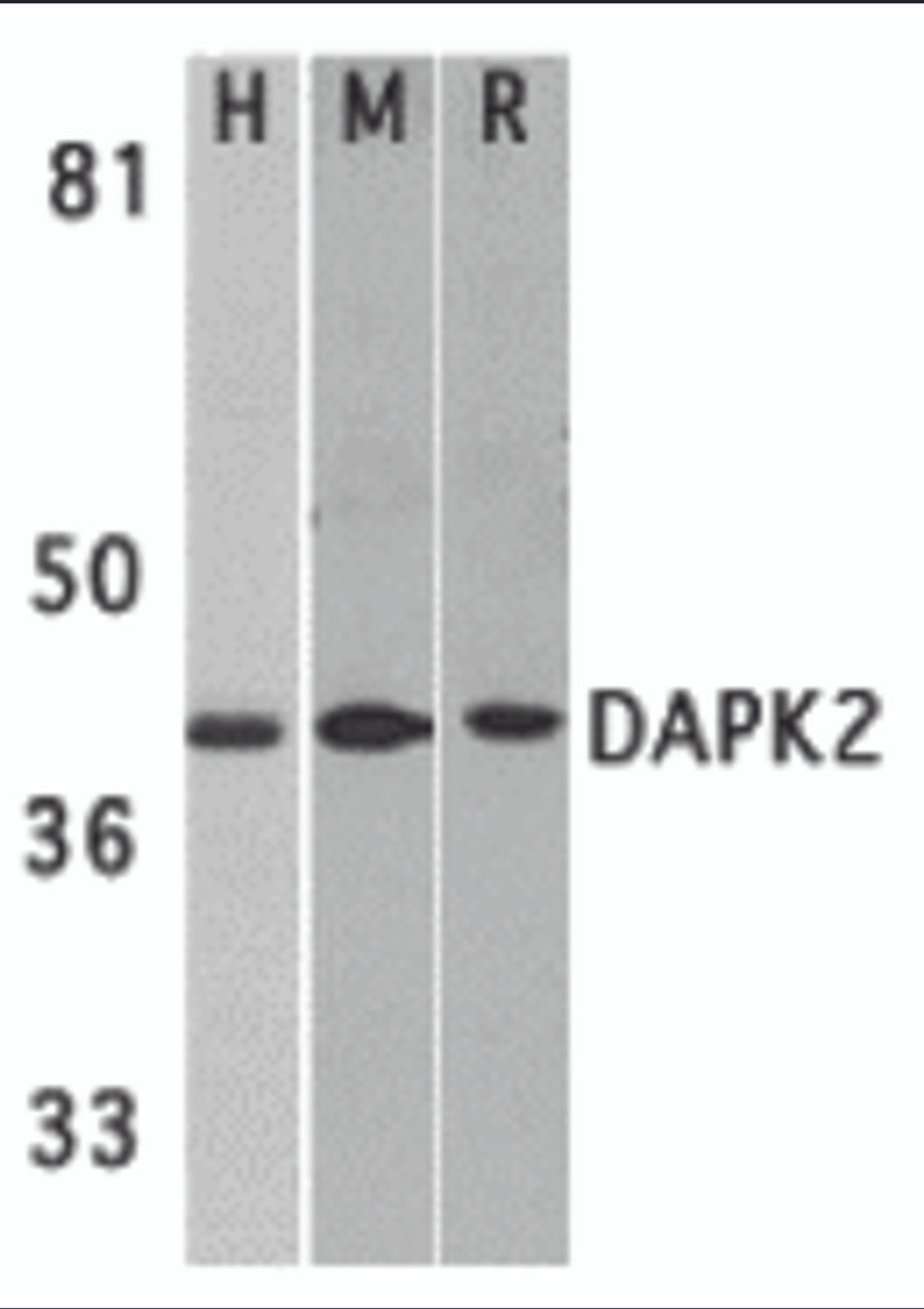 Western blot analysis of DAPK2 in A431 (H) , mouse spleen (M) , and rat kidney (R) lysates with DAPK2 antibody at 1 &#956;g/mL.