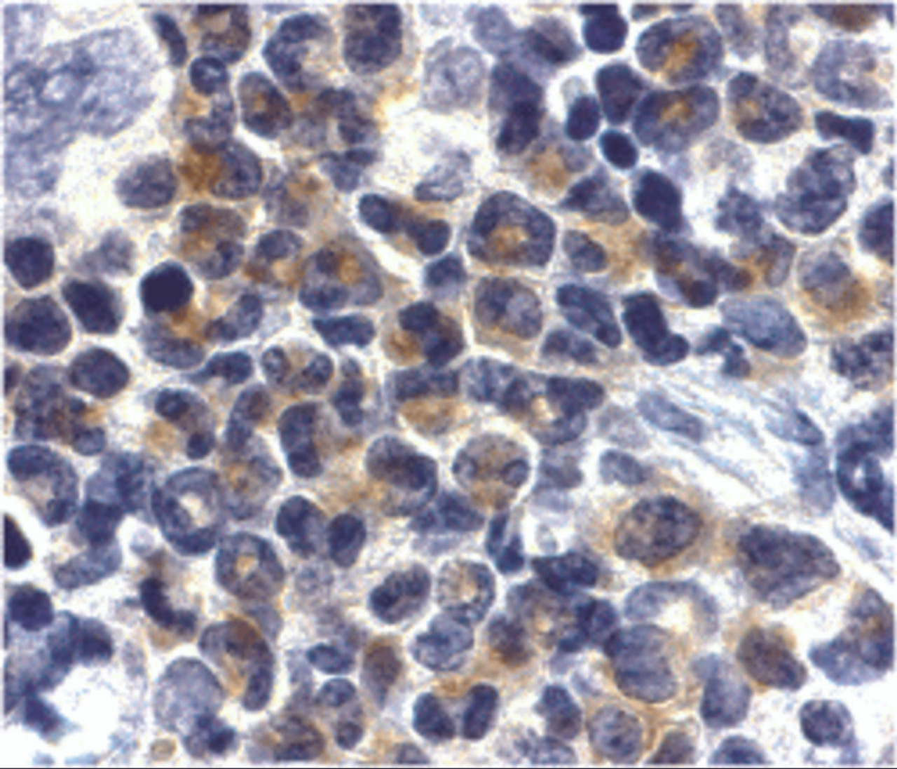 Immunohistochemistry of DAPK2 in mouse spleen cells with DAPK2 antibody at 2 ug/mL.