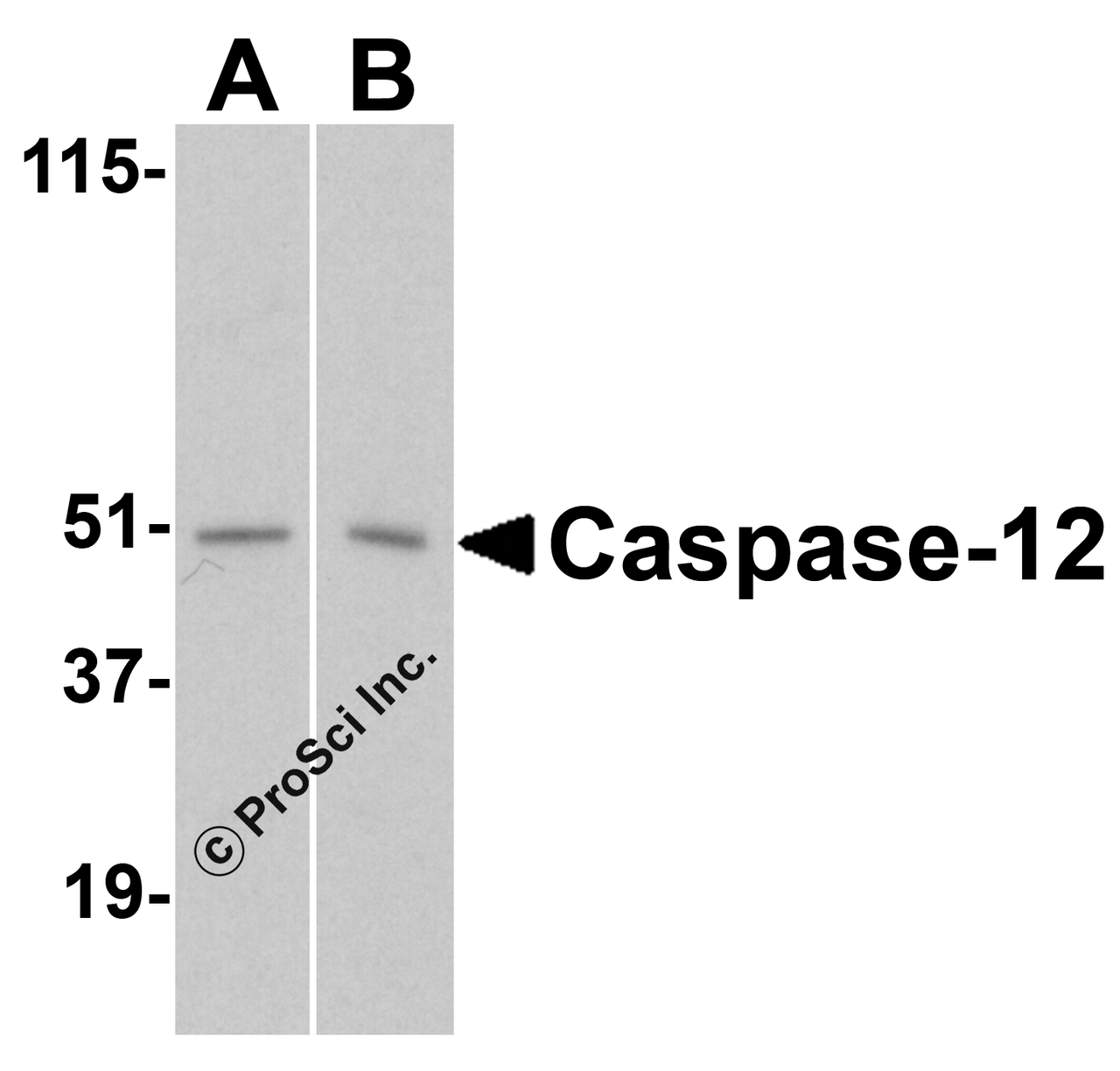 Western blot analysis of caspase-12 in (A) human and (B) mouse spleen tissue lysates with caspase-12 antibody at 1 &#956;g/mL.