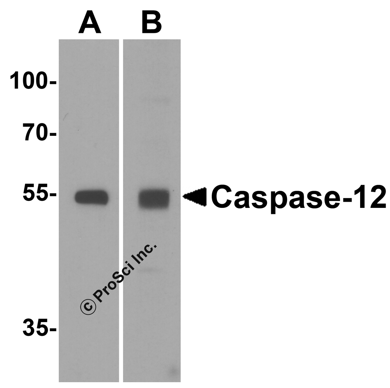 Western blot analysis of Caspase-12 in (A) human spleen and (B) mouse spleen tissue lysate with Caspase-12 antibody at 1 &#956;g/mL.