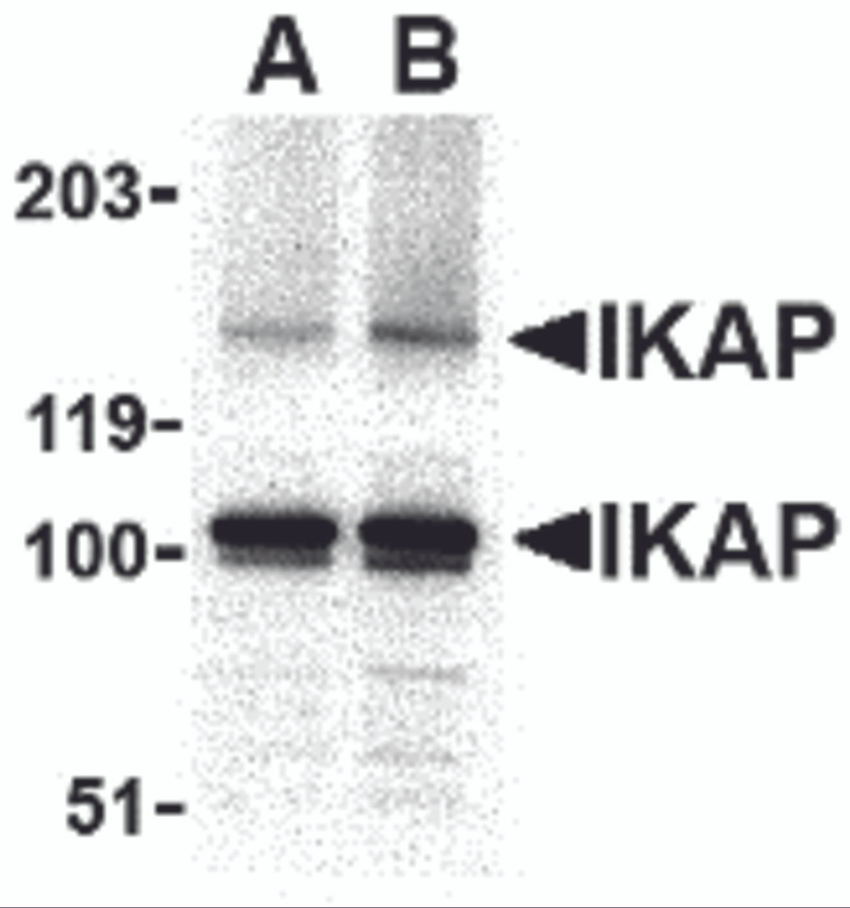 Western blot analysis of IKAP in A-20 cell lysate with IKAP antibody at in (A) 0.5, and (B) 1 &#956;g/mL.
