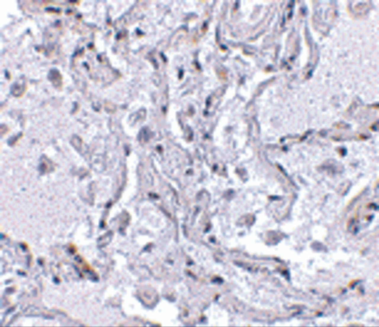 Immunohistochemical staining of human lung tissue using TP1 antibody at 2.5 ug/mL.