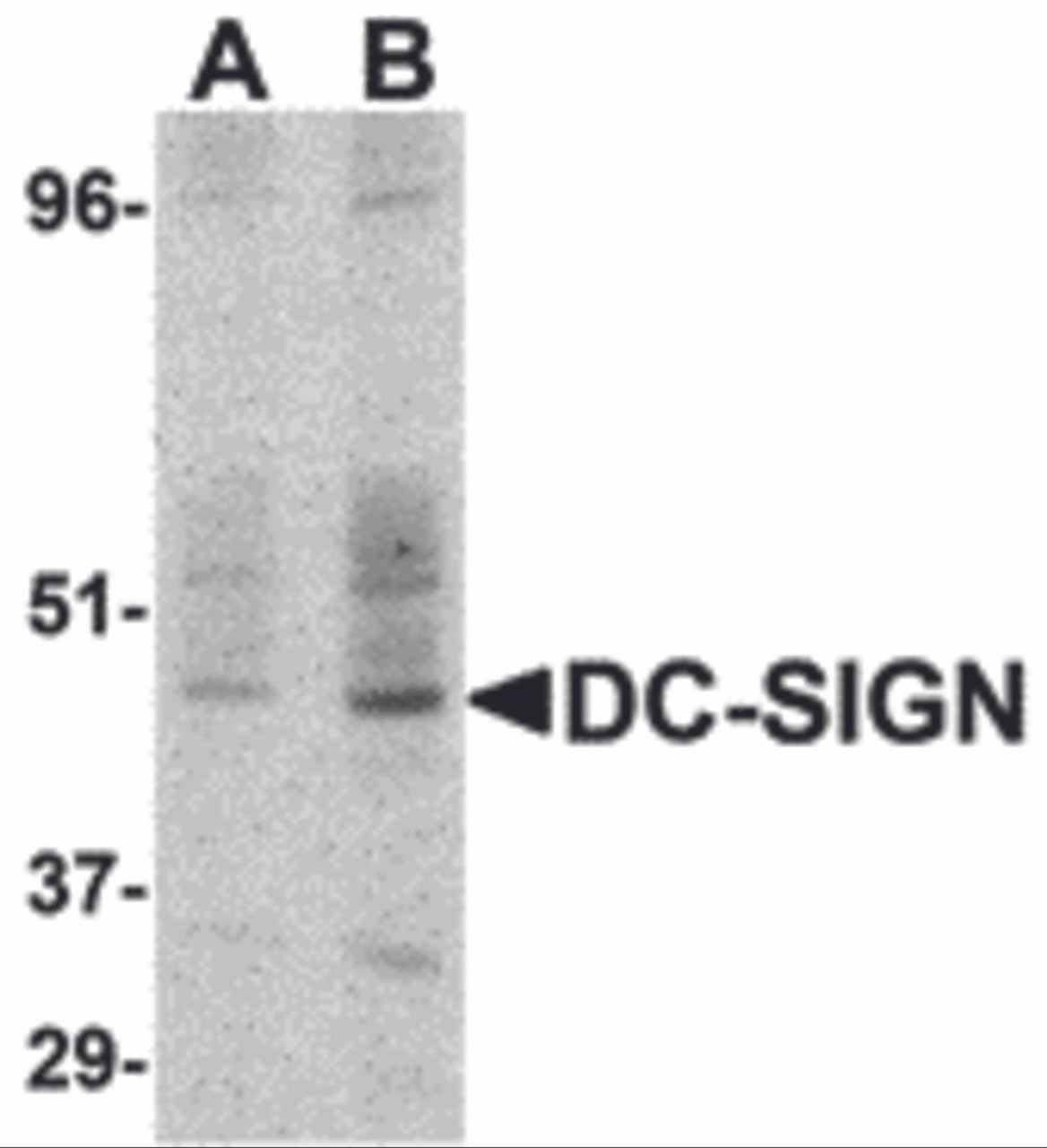 Western blot detection of DC-SIGN in human small intestine at (A) 1 and (B) 2 &#956;g/ml.