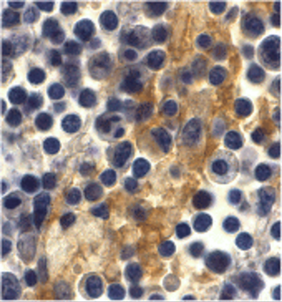 Immunohistochemistry of DC-SIGN in human lymph node tissue with DC-SIGN antibody at 10 ug/mL.