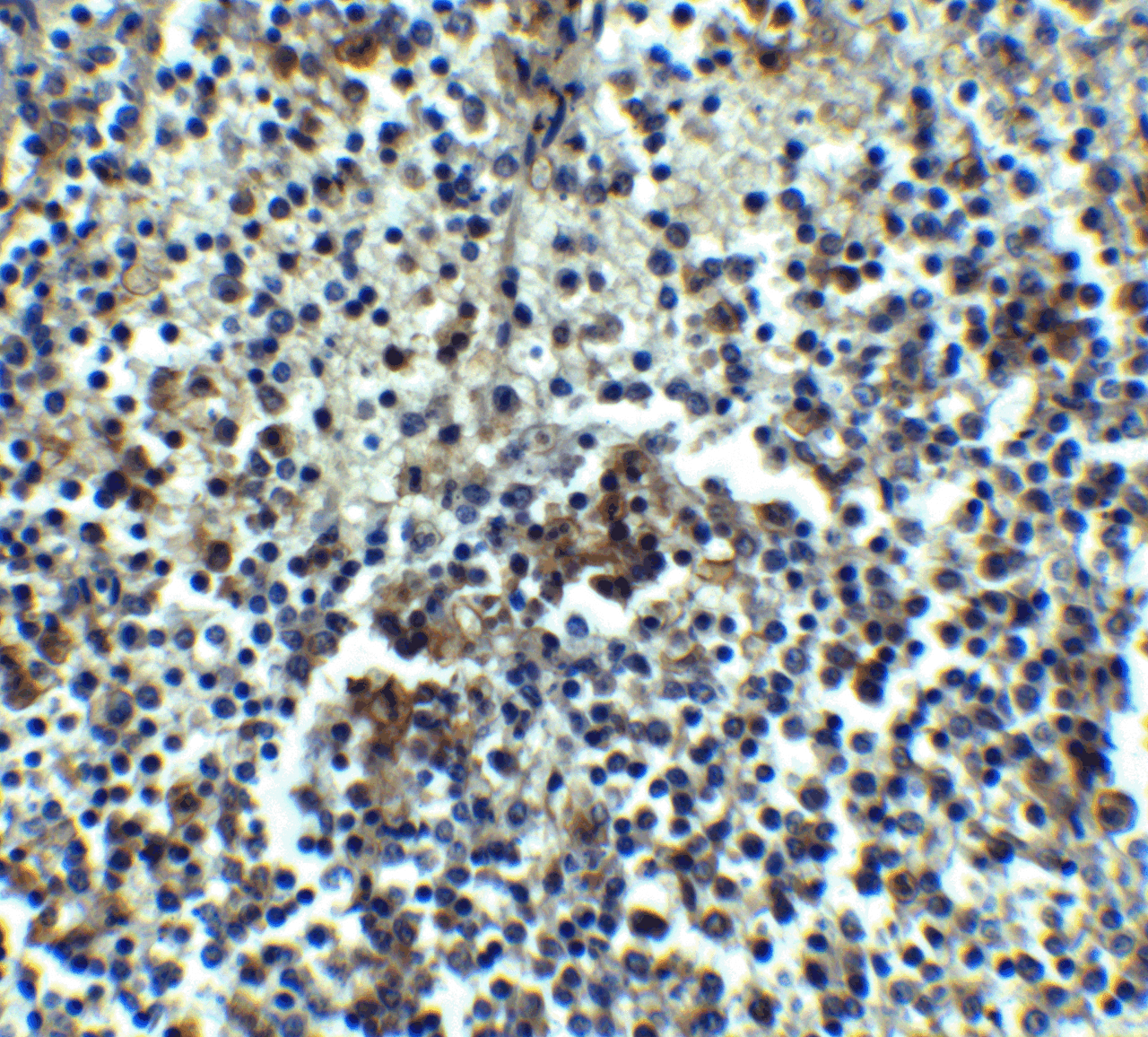 Immunohistochemistry of IRAK-M in human spleen tissue with IRAK-M antibody at 5 ug/mL.