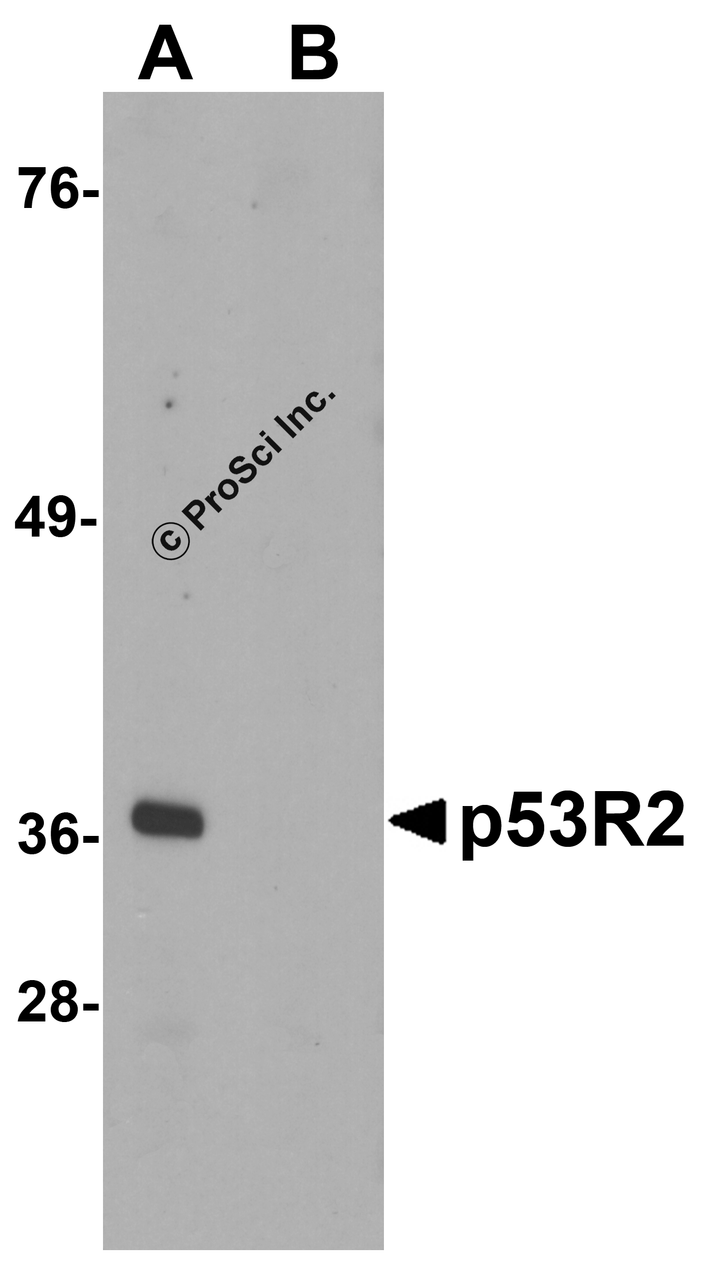 Western blot analysis of p53R2 in 3T3 cell lysate with p53R2 antibody at 1 &#956;g/mL in (A) the absence and (B) the presence of blocking peptide.