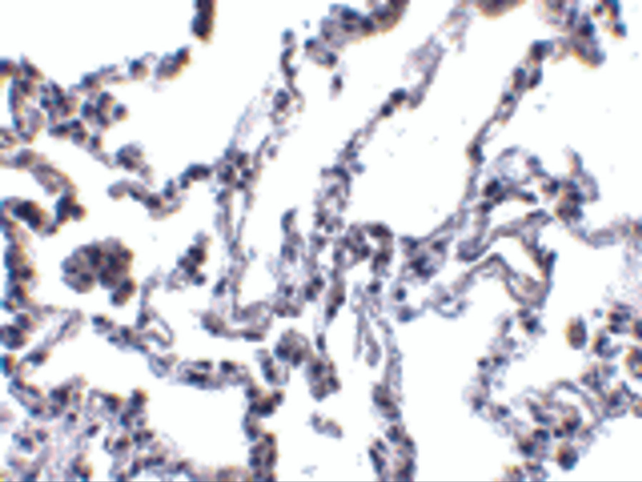 Immunohistochemistry of p53R2 in human lung tissue with p53R2 antibody at 1 ug/mL.