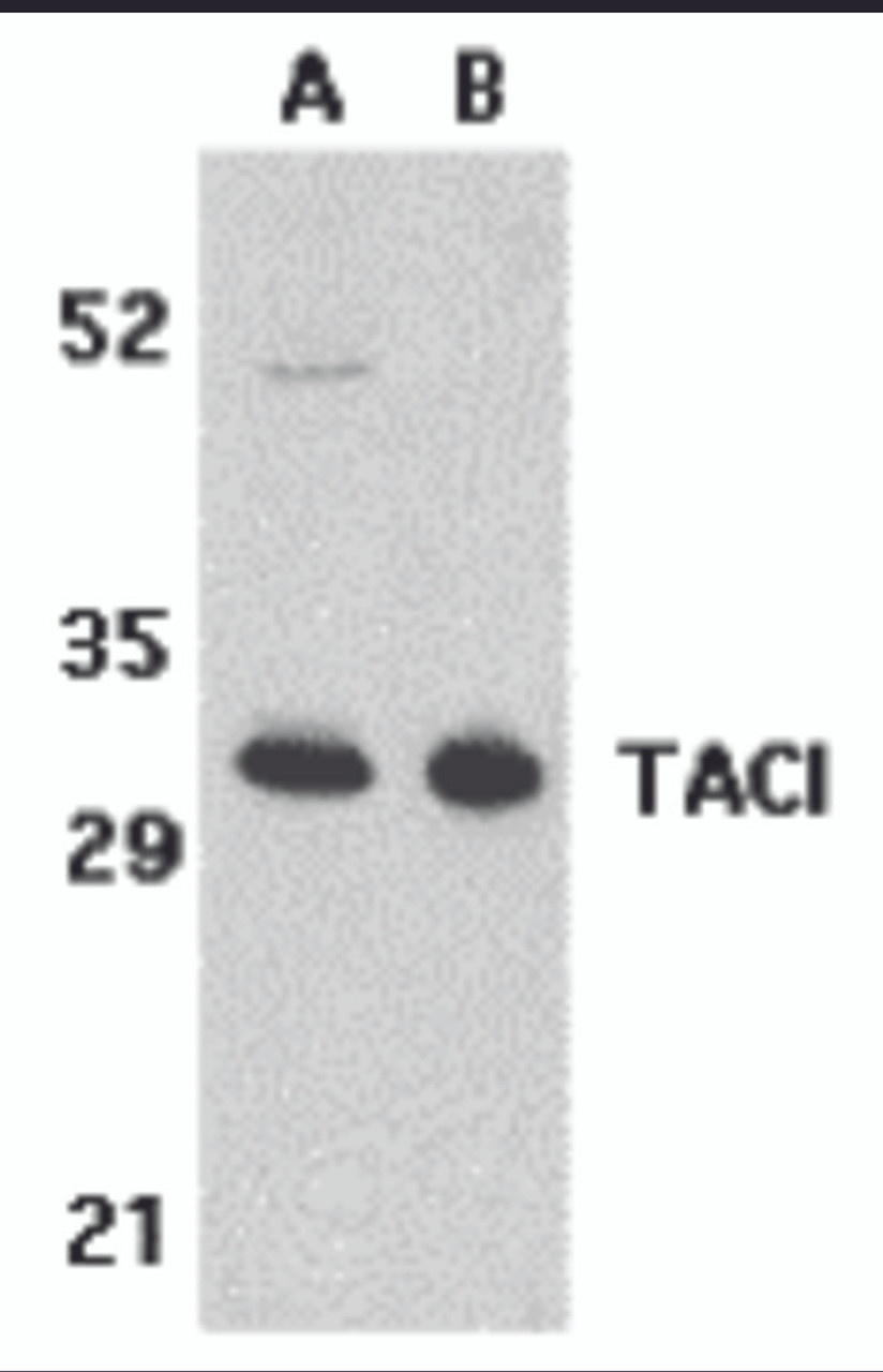 Western blot analysis of TACI in K562 (A) and U937 (B) cell lysates with TACI antibody at 5 &#956;g/mL.