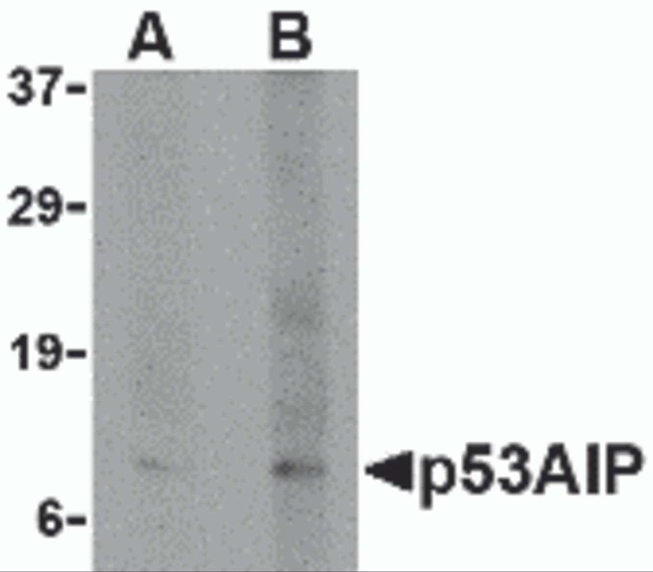 Western blot analysis of p53AIP1 in HL60 cell lysate with p53AIP1 antibody at (A) 4 and (B) 8 &#956;g/mL.